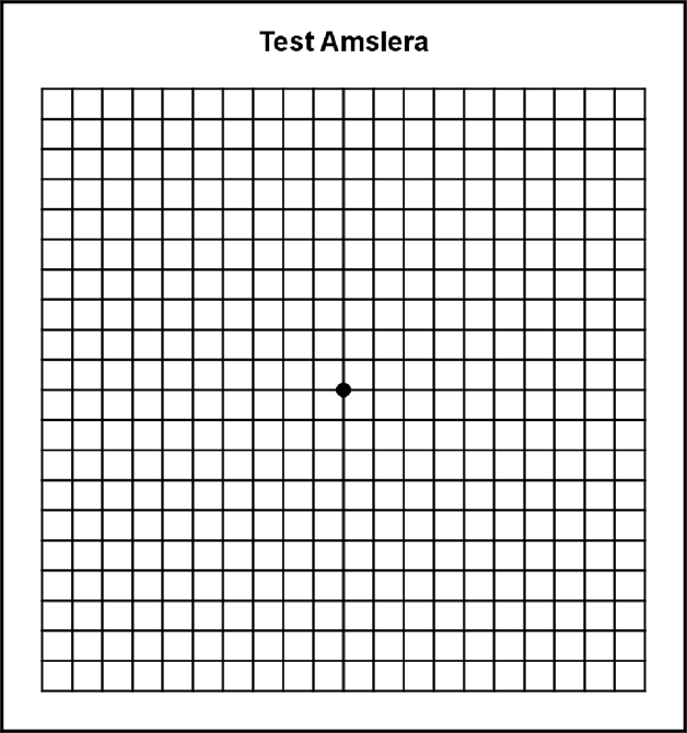 Test Amslera
